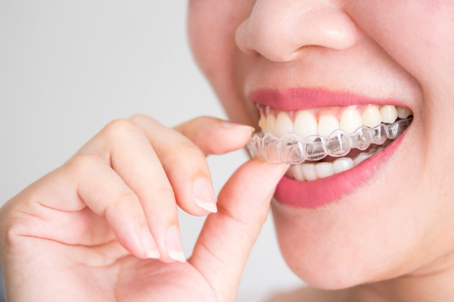 Plataformas como Amazon y Aliexpress venden férulas de descarga, ortodoncias y blanqueamientos, artículos que pueden conllevar un riesgo para la salud cuando no están prescritos por un dentista. FOTO: CGD