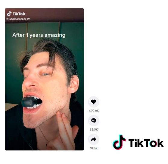 Los peligros virales de 'TikTok': aparatos para ejercitar la mandíbula