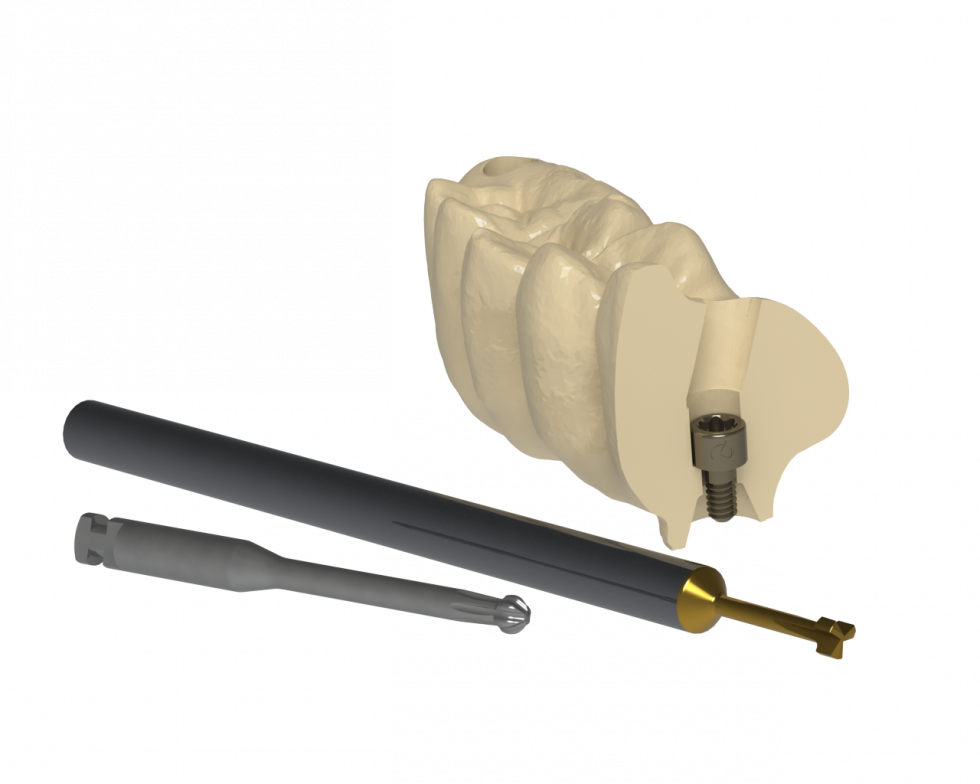 GRAPHENANO DENTAL_G-DAS