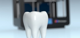 3d printing in medicine_impresion_3D_dm65