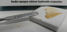 Fig. 1. Hidróxido de calcio en forma de pasta base y catalizador para posterior mezclado y colocación como base cavilara para proteger el complejo dentino-pulpar.