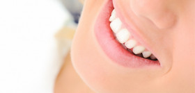 blanqueamiento_dental