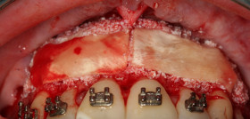 Figura 1D (5B). FOTO: Periocentrum