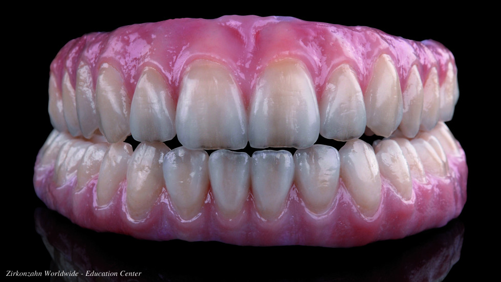 Puente Prettau® realizado con zirconia Prettau® 2. FOTO: Zirkonzahn