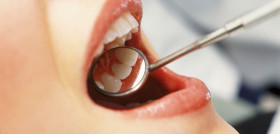 Detectar los síntomas orales de la enfermedad es clave para el diagnóstico precoz de esta afección. FOTO: Sanitas