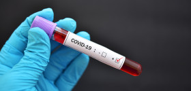 Fenin manifiesta el compromiso del sector con la prevención, el diagnóstico y el tratamiento frente al coronavirus. FOTO: 123RF