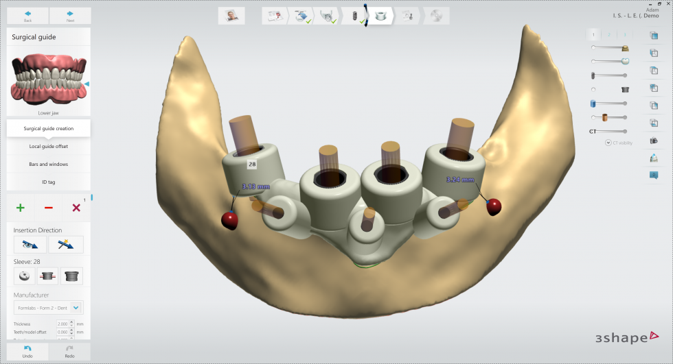 3Shape Implant Studio 2020 Bone supported guide