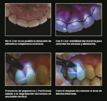 Losada 2