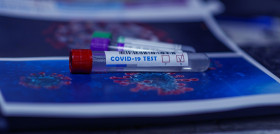 COVID_TEST_NEGATIVO