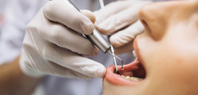 herramientas_odontología_Consejo_guantes_manos_dentista