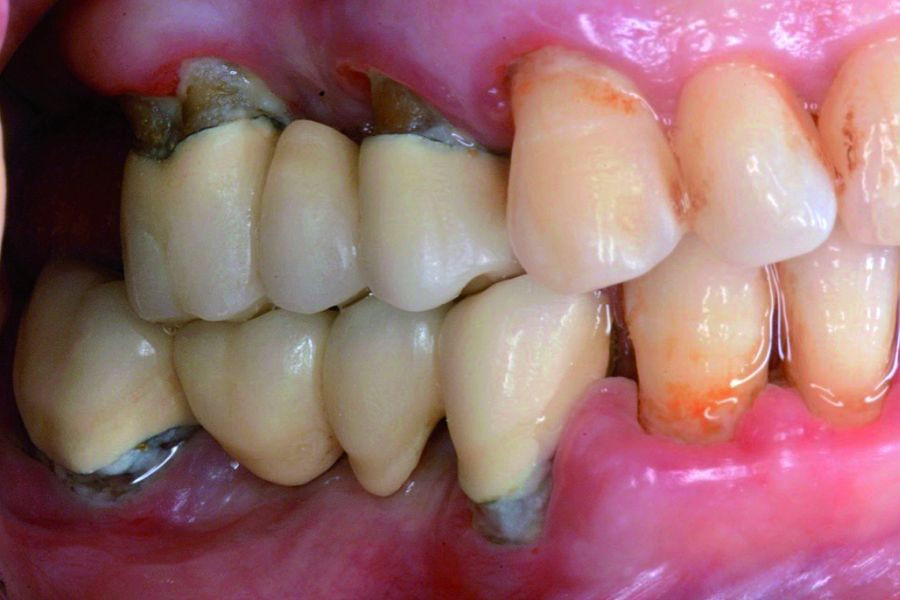 ActualizacionMonografiaPeriodoncia_DM5_ClaudioMongardini