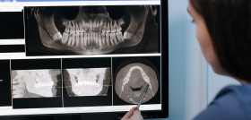 RADIOGRAFÍA_RAYOS X_DENTAL4