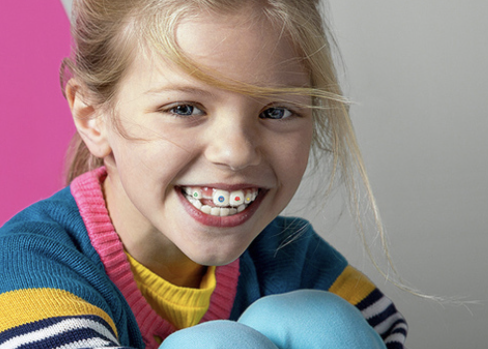 Invisalign_stickables_1