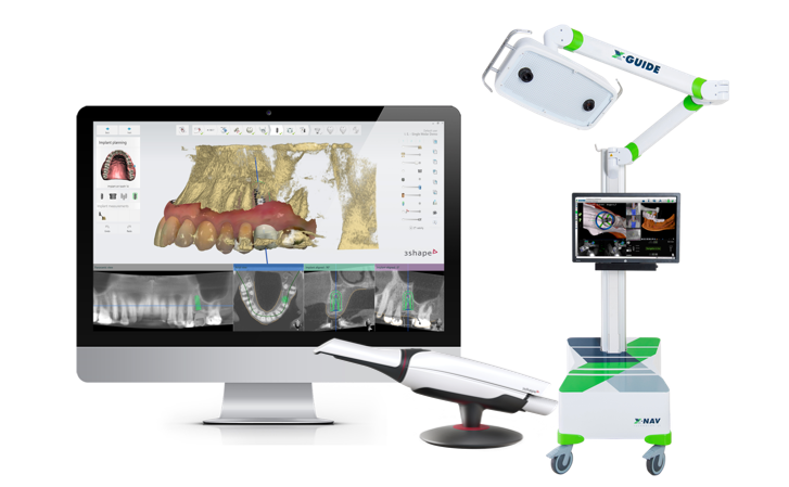 3Shape_Implant Studio 2021.2_X-Guide product image (1)