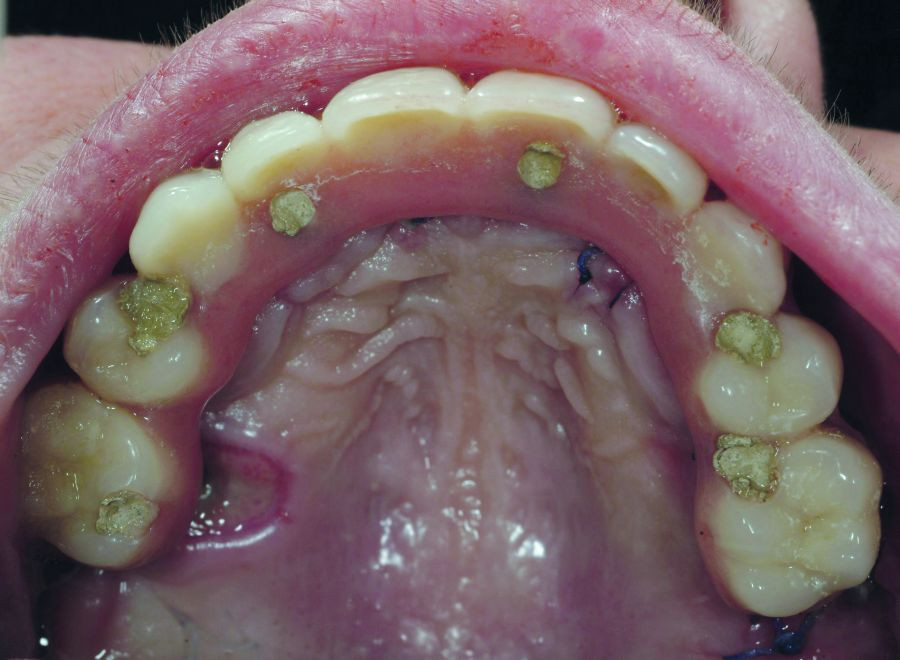 Investigacion_DM2_CarlosAparicio