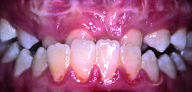 Ortodoncia_DM2_GiovanaGarattini