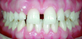 Ortodoncia_DM3_DanieleCantarella