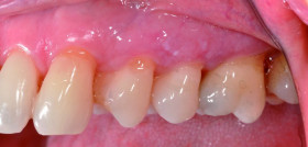 PatologiaOral_DM4_AldoLuigiGiglio