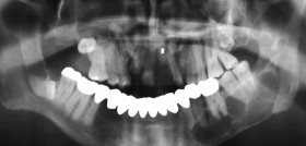 Cirugia_DM4_PaoloOrdesi
