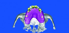Cirugia_DM7