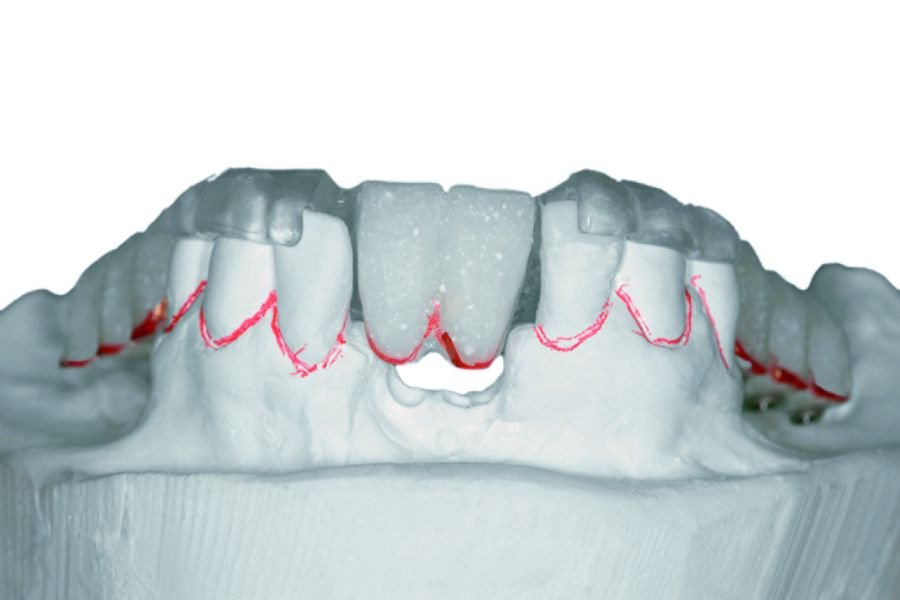 Periodoncia_implantologia-DM6