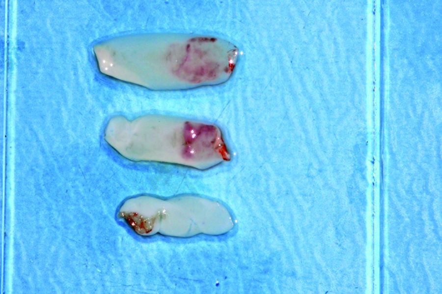 Cirugia_DM6_1_24