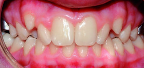 Ortodoncia_odontologia_DM6
