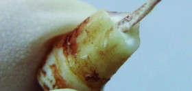 MedicinaLegalForense_DM6_1