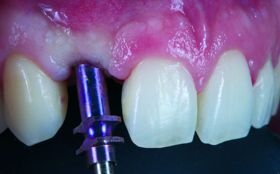 Peridoncia_Implantologia_DM8