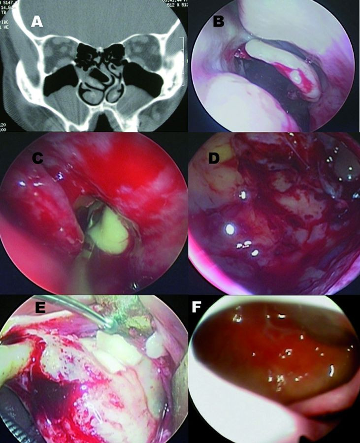 PatologiaOral_DM8