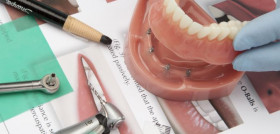 curso mld pt 3_6
