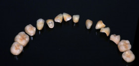 DM10_Prostodoncia