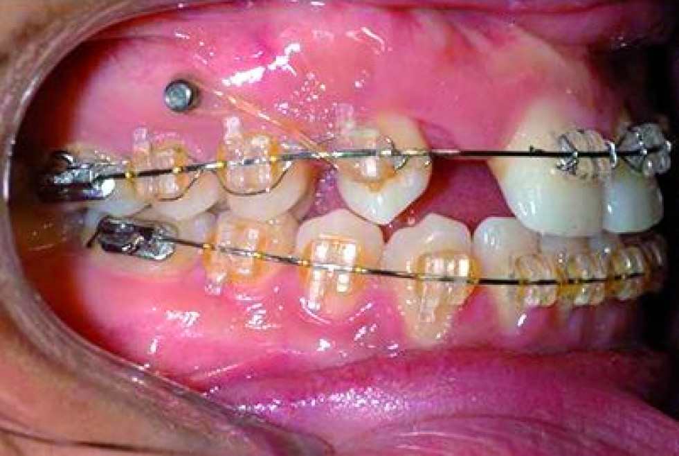 DM13_ortodoncia