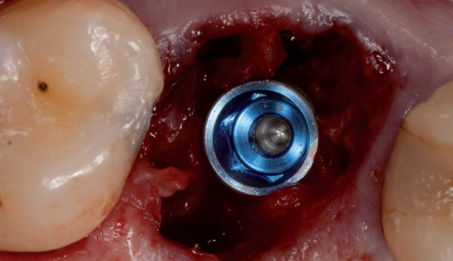 Implantatologia_DM18