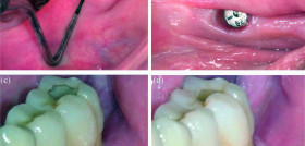 DM30_Periodoncia_SanzMartin
