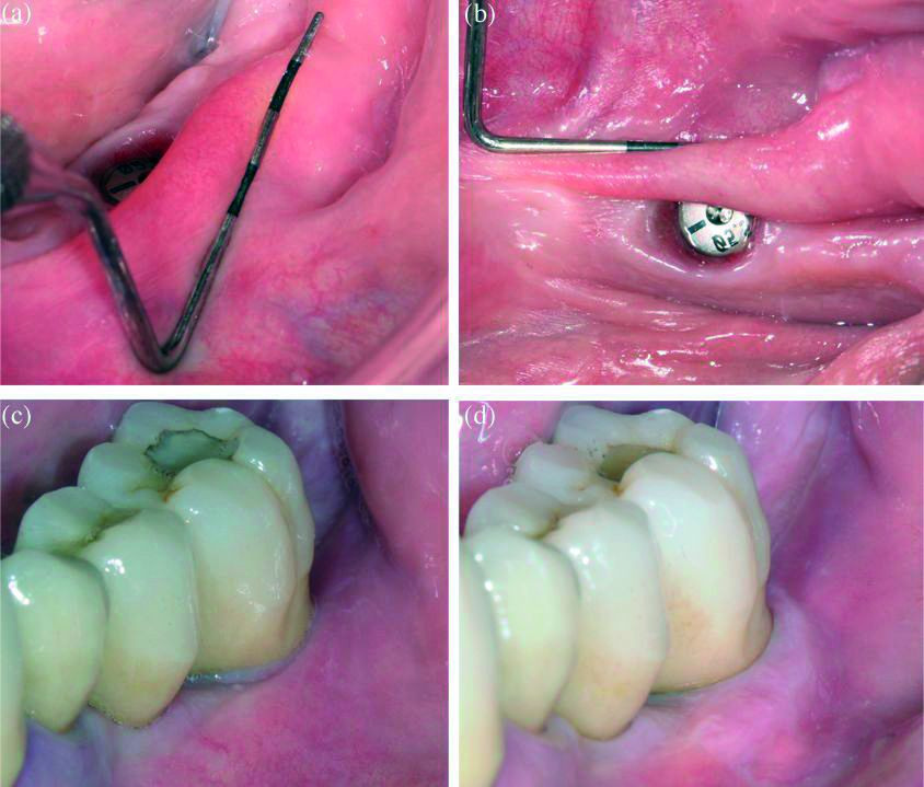 DM30_Periodoncia_SanzMartin