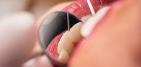 Macro shot of girl having dental check up in dental clinic. Dentist examining a patient's teeth with dental tools - mirror and probe. Dentistry