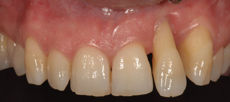 Sepa1