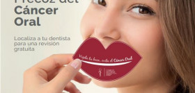 Campaña Diagnóstico Precoz del Cáncer Oral
