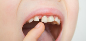 La RNO tiene como objetivo reequilibrar la boca para mantener su salud y la del resto del organismo. FOTO: CSD