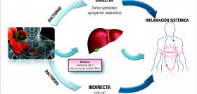 Figura 1. Mecanismos plausibles que explican la asociación entre periodontitis y enfermedades cardiovasculares.