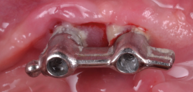 Figura2_casoSEPA_DM66