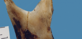 fig5_articulopalafox-dm67_odontología_forense