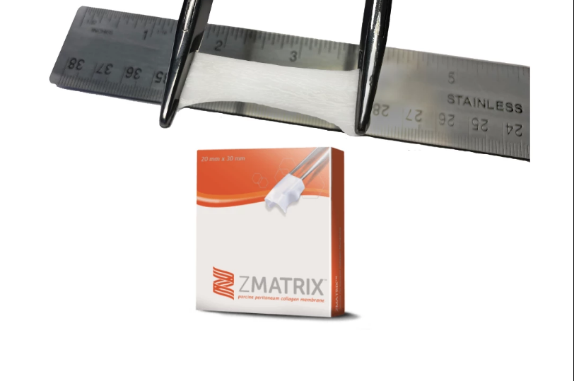 ZMATRIX SALUGRAFT