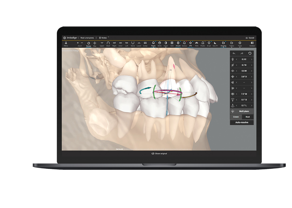 CBCT 1 align