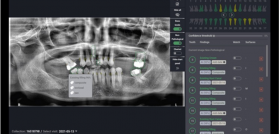 Denti AI REVISION LITERARIA SEPES DM70
