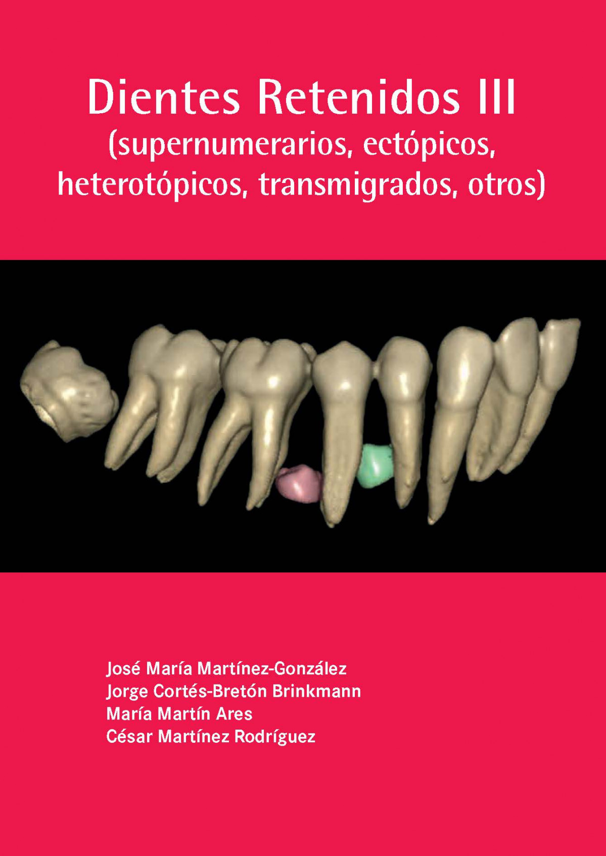 Portada Libro Dientes Retenidos III