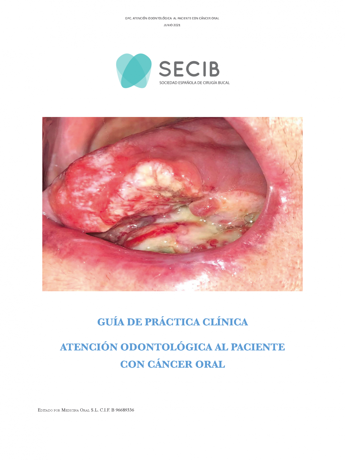 PORTADA GPC Cancer Oral