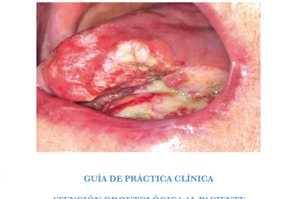 PORTADA GPC Cancer Oral
