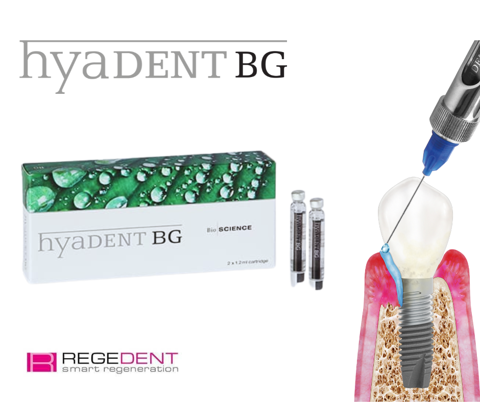 SALUGRAFT HYADENT